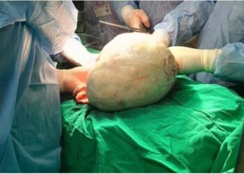 Mjekët në spitalin e Mitrovicës i heqin 15 kilogramë tumor një 65 vjeçare (FOTO)