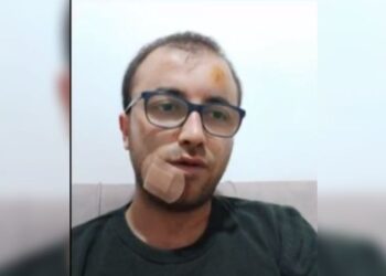 Duriqi tregon për gjendjen e tij pas sulmit që iu bë të mërkurën