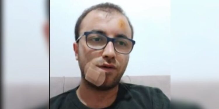 Duriqi tregon për gjendjen e tij pas sulmit që iu bë të mërkurën