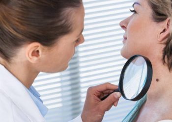 Kontrolloni me lehtësi lythat tuaja duke përdorur teknikën e ekzaminimit ABCDE