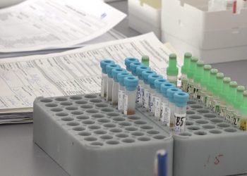 Klinika e Biokimisë në QKUK ka pranuar rreth 300 mijë pacientë kërkojnë shërbime!