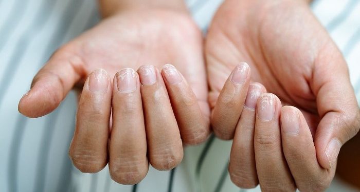 Thonjtë përmes këtyre shenjave na tregojnë shumë