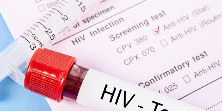 Dita botërore e HIV/AIDS, rritet numri i të infektuarve në Kosovë