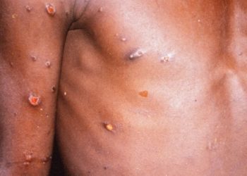 Çfarë thonë ekspertët për Linë e majmunëve!