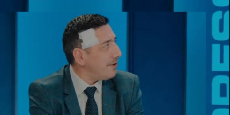 Arrestohen autorët e sulmit ndaj Valon Sylës