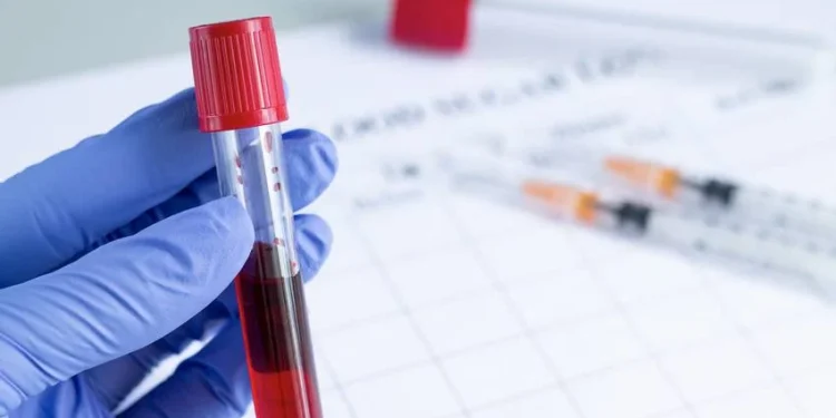 Cilat janë simptomat të leukemisë?!