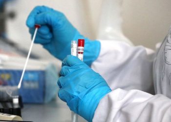 Shfaqet varianti i ri i Covid-19, po përhapet në mbarë botën