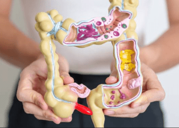 Cilat ushqime e shkaktojnë inflamacioni i zorrës së trashë dhe kujdesi që ju duhet patjetër