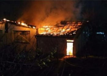 Tragjedia e Koçanit: Tek disa pacientë janë kryer transplantimi të lëkurës