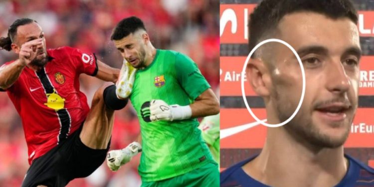 Kështu duket fytyra e portierit Garcia pas ndërhyrjes brutale të Vedat Muriqit