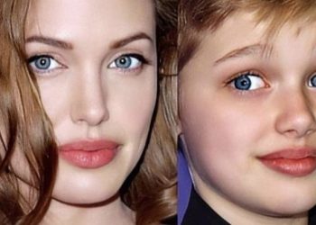 7 tiparet gjenetike që trashëgohen vetëm nga njëri prind