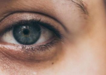 Çfarë të bëni për rrathët e zinj poshtë syve, këshilla nga ekspertë